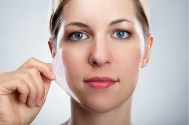 chemical peels (1)